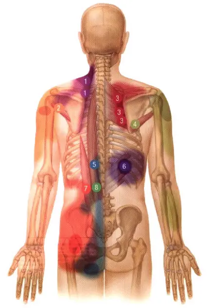 Qu'est-ce que les points trigger et points Knap?